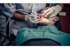 Effective Wisdom Teeth Infection Treatment Options Explained