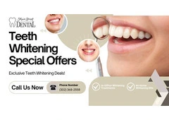 Bright Smiles with Expert Teeth Whitening in Newark
