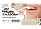 Bright Smiles with Expert Teeth Whitening in Newark