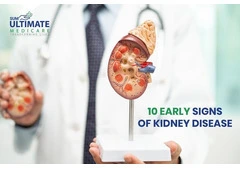 10 Early Signs of Kidney Disease You Must Know
