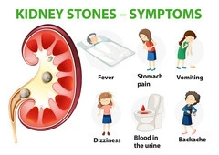 Signs You Need to See a Kidney Stone Specialist
