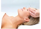 Acupuncture Treatment in Toronto: Holistic Therapy Aimed At Pain Relief And Renewal