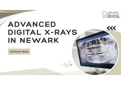 Advanced Digital X-Rays in Newark | Safe Dental Imaging