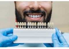 Find minimally invasive Veneers in Tijuana with ultra-thin custom-made shells