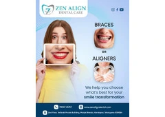 Affordable Dental Braces Kondapur with Modern Orthodontic Care