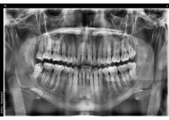 Revive your natural and flawless smiles with holistic Dental care in Tijuana