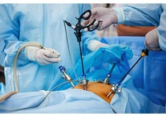 Laparoscopic Surgeon in Delhi