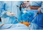 Laparoscopic Surgeon in Delhi