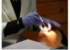 Cosmetic Collingwood Dentist for a Perfect Smile
