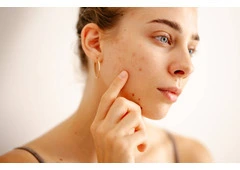 Dermatologist Orlando | Allergy & Asthma Center | Skin check, Acne, Skin Cancer, Moles