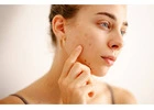 Dermatologist Orlando | Allergy & Asthma Center | Skin check, Acne, Skin Cancer, Moles