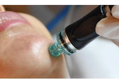 Best Hydrafacial in Chandigarh for Radiant Skin