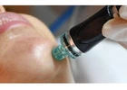 Best Hydrafacial in Chandigarh for Radiant Skin