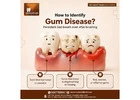 Searching for the Best Dental Clinic in Indirapuram for Your Dental Care?