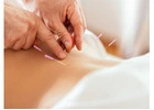 Pain Management Acupuncture in NYC | Back, Neck & Sciatica Relief