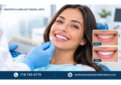 Expert Teeth Whitening from a Trusted Brooklyn Dentist