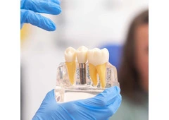 Get your natural look with metal-free Dental crowns in Tijuana from Teeth Savers