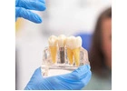 Get your natural look with metal-free Dental crowns in Tijuana from Teeth Savers