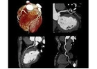 Cardiac CT Craigieburn