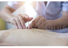 Acupuncturist in Adelaide at Yihong Acupuncture Clinic