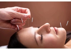 Experience Vibrant Wellness: Acupuncture Therapy Clinic New York City