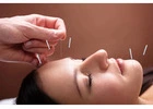 Experience Vibrant Wellness: Acupuncture Therapy Clinic New York City