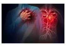 Understanding Heart disease and stroke among Americans