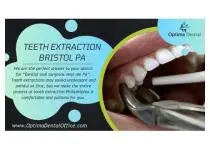 Optima Dental Office - Expert Tooth Extraction Services in Bristol for a Painless Smile Restoration