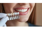 Trusted Bleeding Gums Care & Dental Check Up Somerset for Healthier Smiles