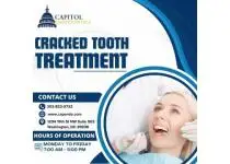 Cracked Tooth Treatment Downtown DC