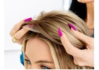 Expert Hair Loss Solutions Dallas